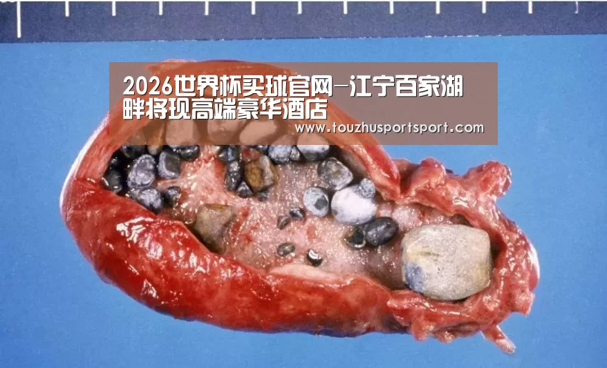 2026世界杯买球官网-江宁百家湖畔将现高端豪华酒店(图2) 2026世界杯买球官网app入口在线